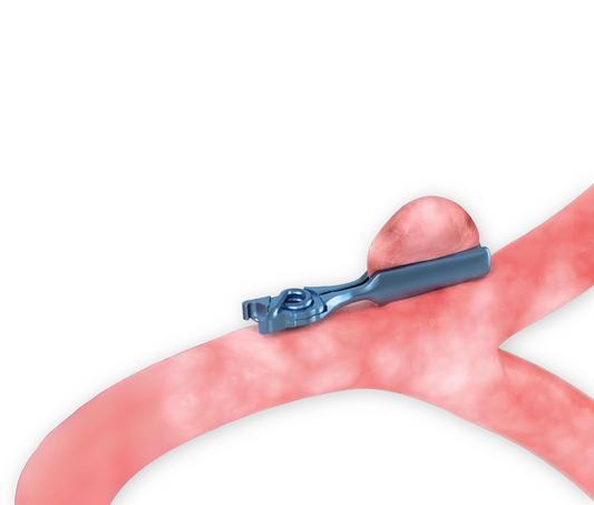 Peter Lazic L-Aneurysm Clips